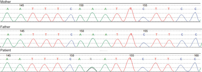 【佳学基因检测】做后颌过小、微小后颌基因解码、基因检测的费用是多少? 【佳学基因检测】做后颌过小、微小后颌基因解码、基因检测的费用是多少?