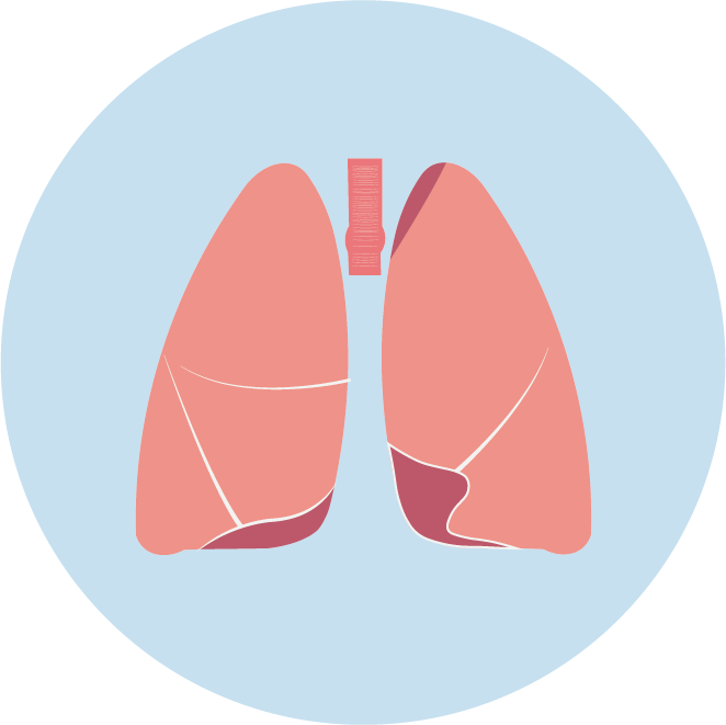 【佳学基因检测】非小细胞肺癌靶向治疗药物泰圣奇基因检测