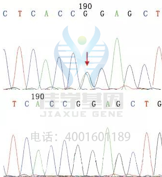 【基因检测基因解码案例】高肌氨酸血症——佳学基因 【基因检测基因解码案例】高肌氨酸血症——佳学基因
